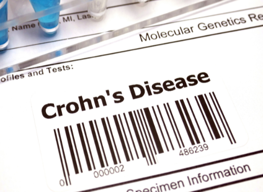 Can you exercise with Crohn’s disease? Benefits and precautions
