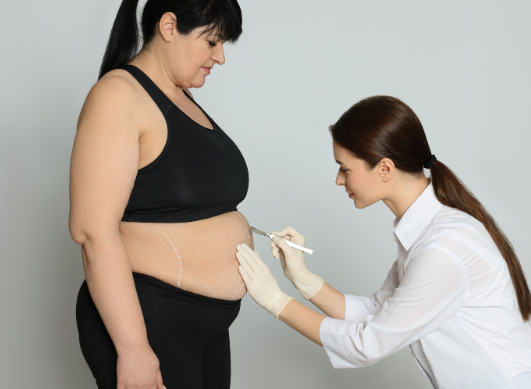 How to avoid nutritional deficiencies after bariatric surgery?