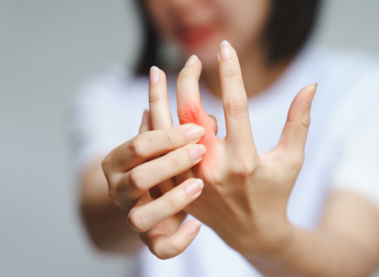 What are the complications of rheumatoid arthritis (RA)?