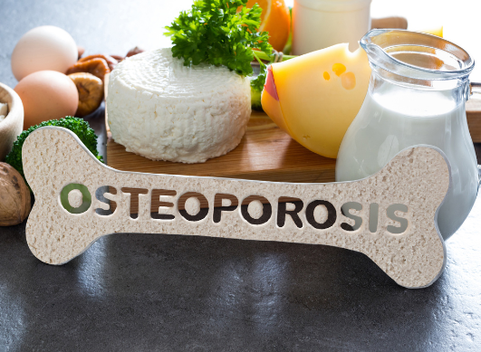Osteoporosis and diet: What should you eat (and avoid) for stronger bones?