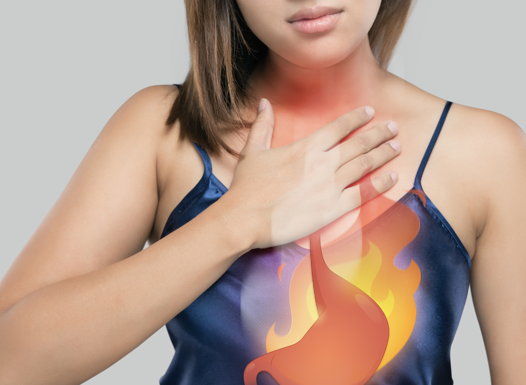 Gastro-oesophageal reflux disease (GORD): causes, symptoms and treatments
