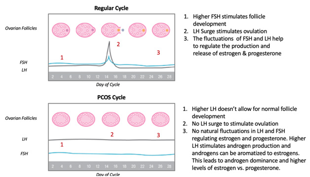 Changes in menstrual cycle with PCOS